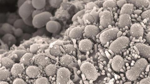 Widely Available Antibiotics Could Be Used to Treat “Superbug” MRSA