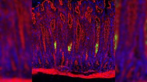 Gastric Stem Cells Fight Bacteria to Protect Themselves Against Cancer