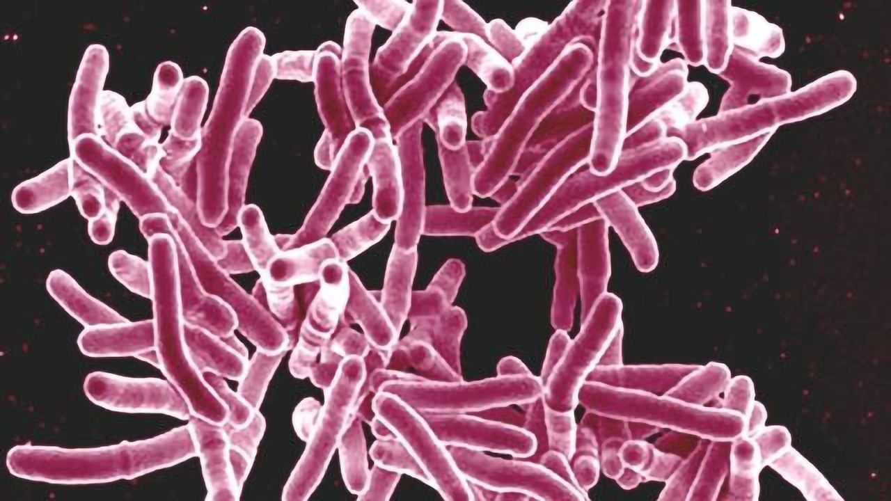 Clinical Trial Assessing Treatments for Preventing People at High Risk From Developing Multidrug-resistant TB Launches