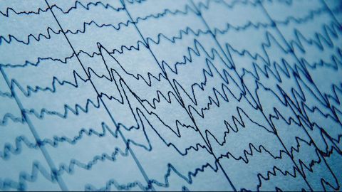 "Hidden Consciousness" Could Predict Recovery for Brain Injury Patients