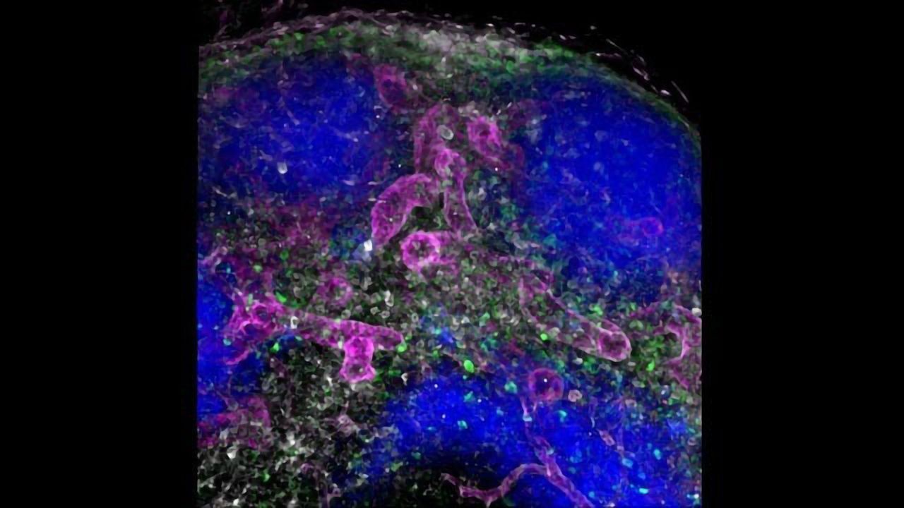 New Route Transports Administered Antibodies into Lymph Nodes in Seconds