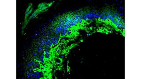 Investigating Cancer Resistance of the Naked Mole-Rat