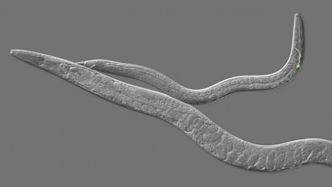 The Missing Link: What Can One Gene Tell Us About Puberty Onset?