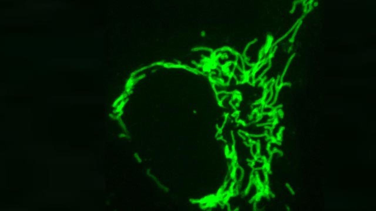 Antibody-based Probe “Frankenbody”: A New Tool for Live-cell Imaging