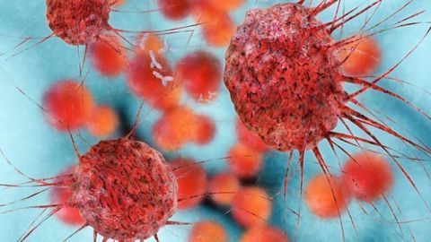 Strain of Common Cold Virus Attacks and Destroys Bladder Cancer Cells