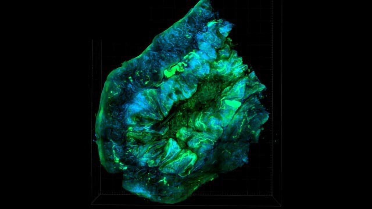 Ovarian Cancer Cells "Totally Addicted to Ran", a Key Mobility Protein