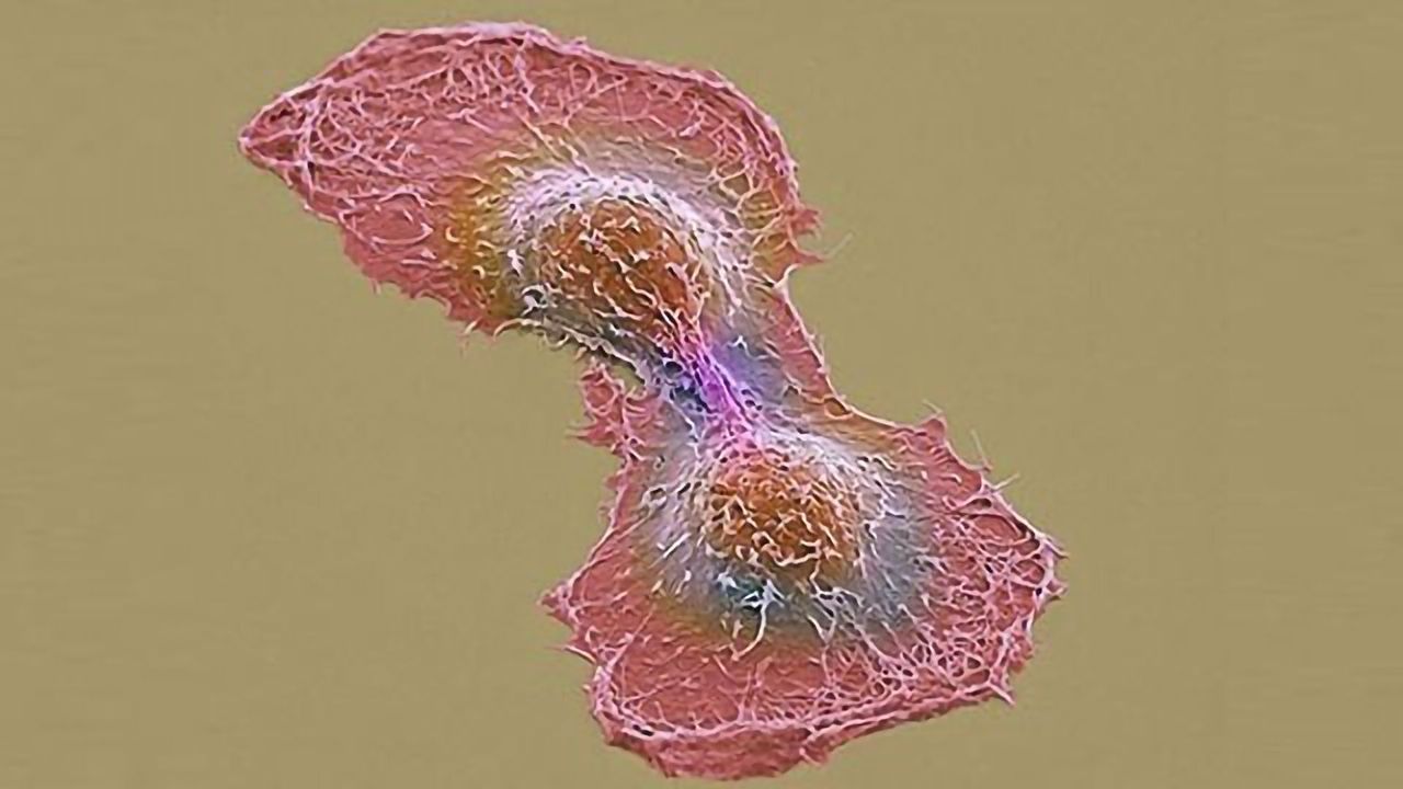 A New Drug Target for Multiple Tumor Types
