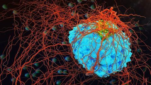 Alternate Cell Growth Pathway May Lead to Better Metastatic Cancer Treatments