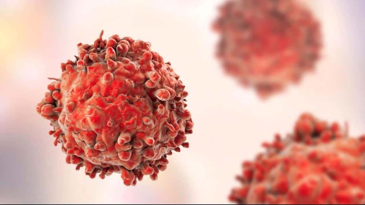 Preventing Protein From “Doing Its Job” Could Stop Ovarian Cancer Cells From Spreading