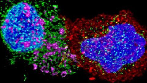 Controlling HIV Infection by Reprogramming Immune Cells