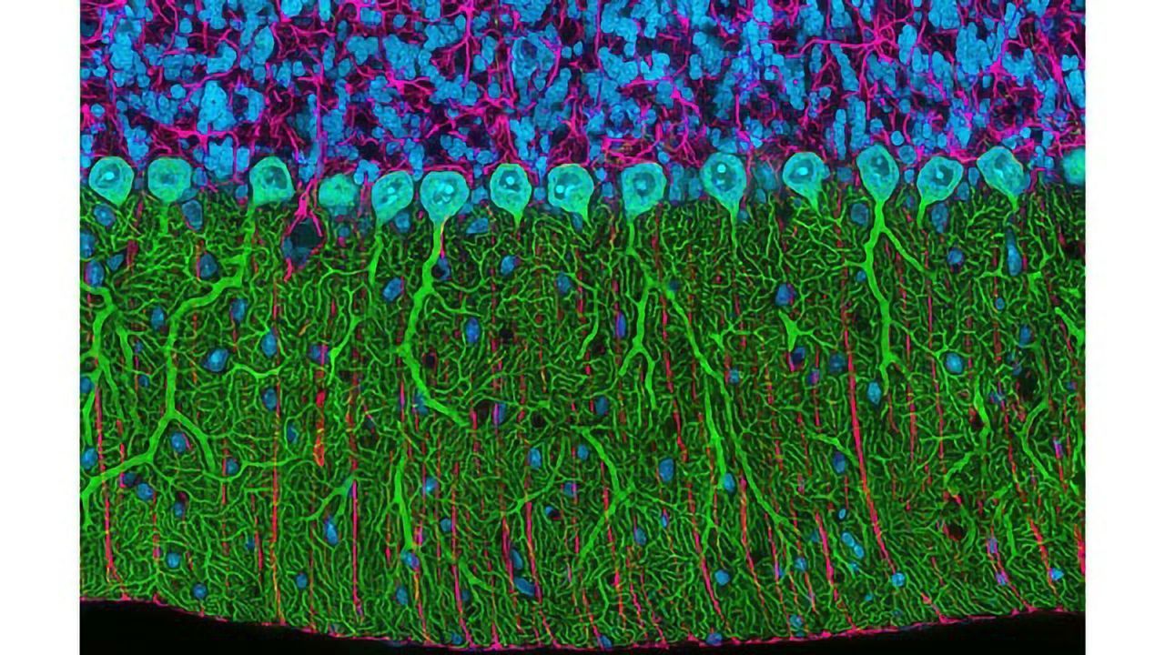 Cerebellum