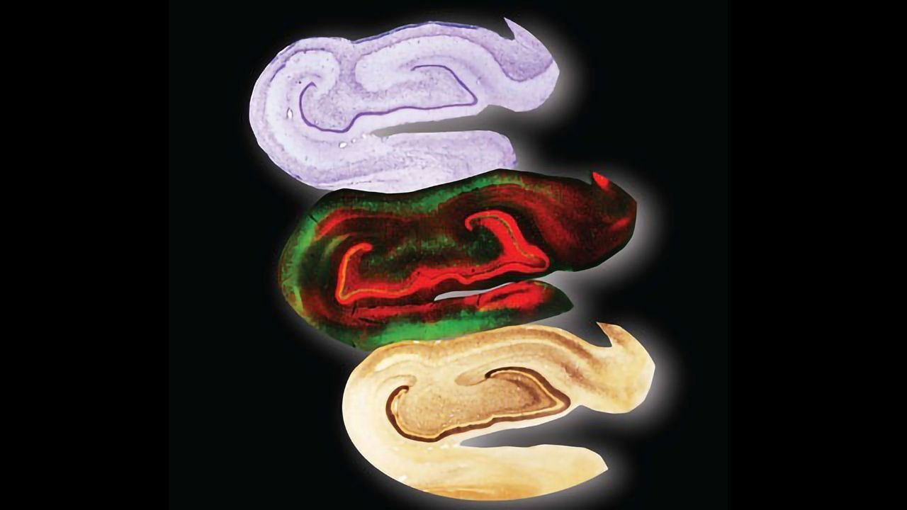Sections of Primate Brain