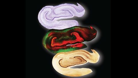 Sections of Primate Brain