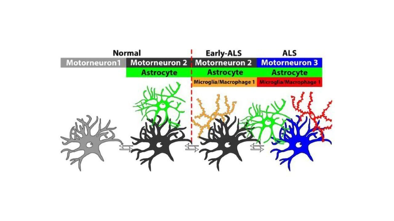 Unique Neuronal Populations Could Be Biomarkers for ALS