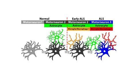 Unique Neuronal Populations Could Be Biomarkers for ALS