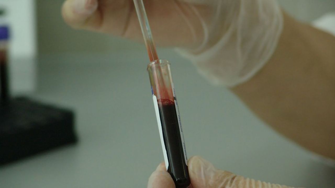 Randox RX series gains NGSP Certification for Direct HbA1c