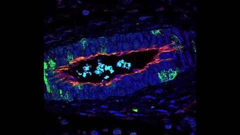 p38 Protein Regulates Angiogenesis in Colon Cancer
