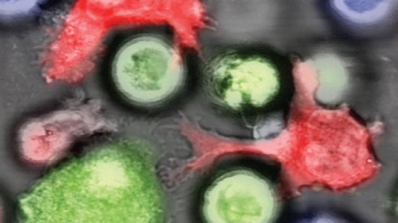 Removing Cancer Stem Cells’ "Invisibility Cloak"