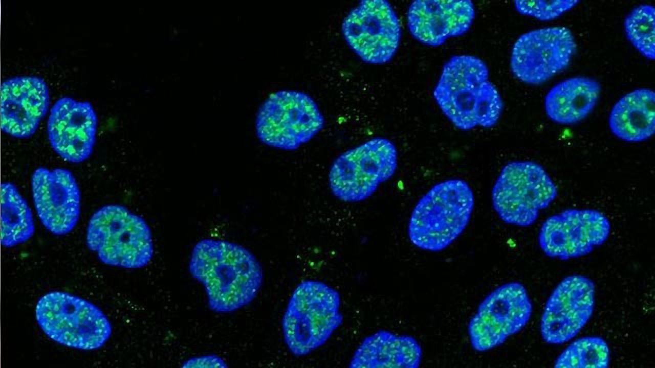 “Slug” Keeps Breast Stem Cell Health in Check