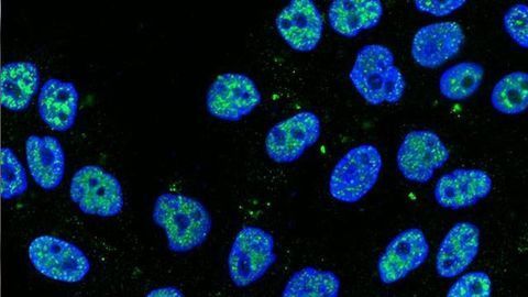 “Slug” Keeps Breast Stem Cell Health in Check