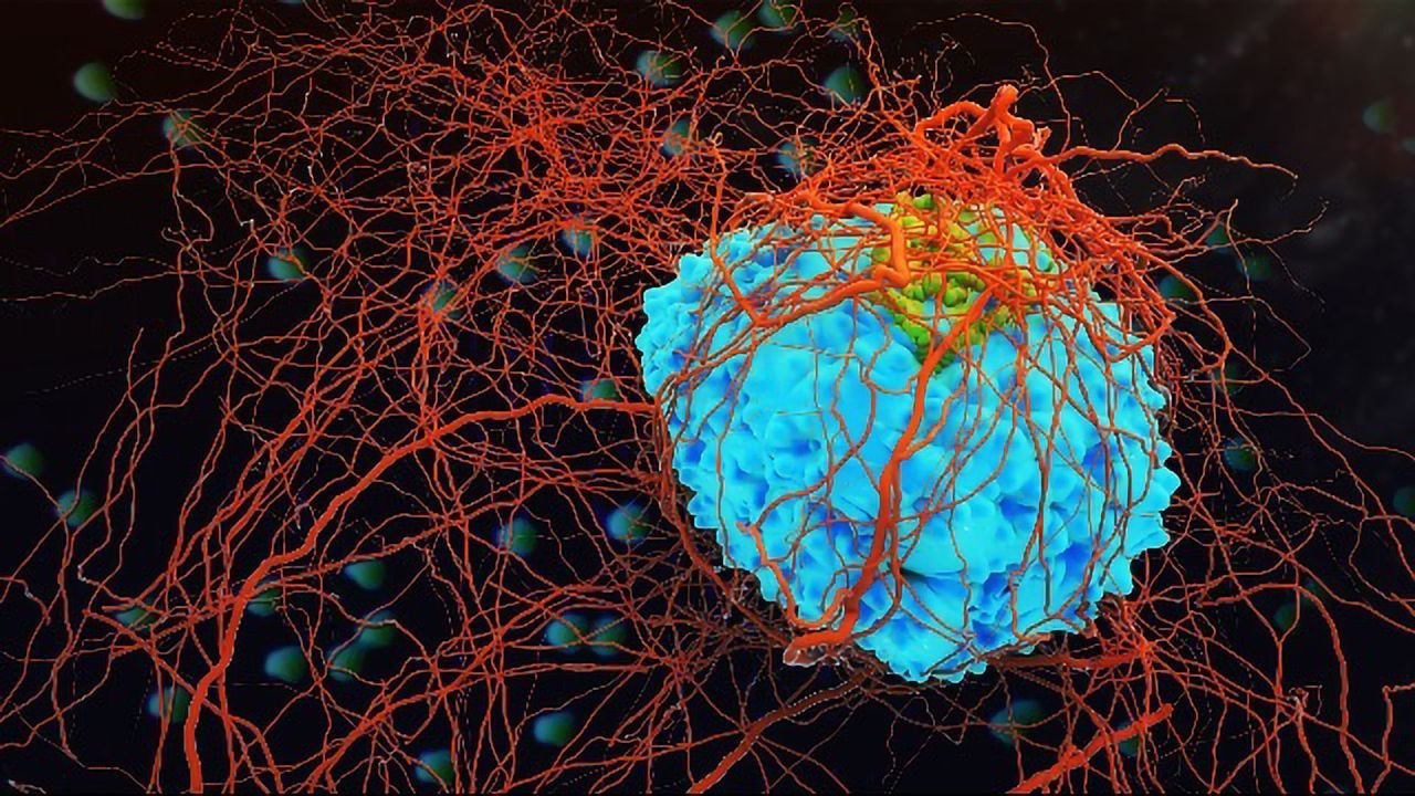 Aurora Supercomputer to Assist in the Fight Against Cancer