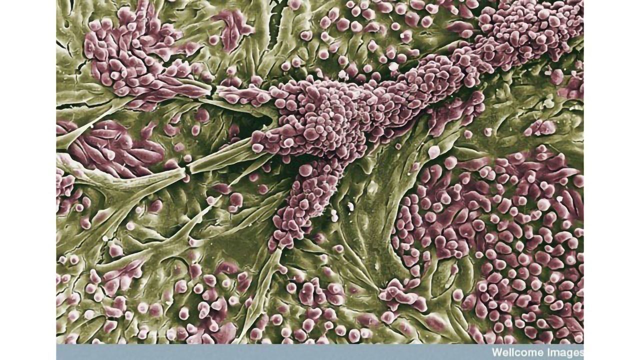 Human Proximal Tubule