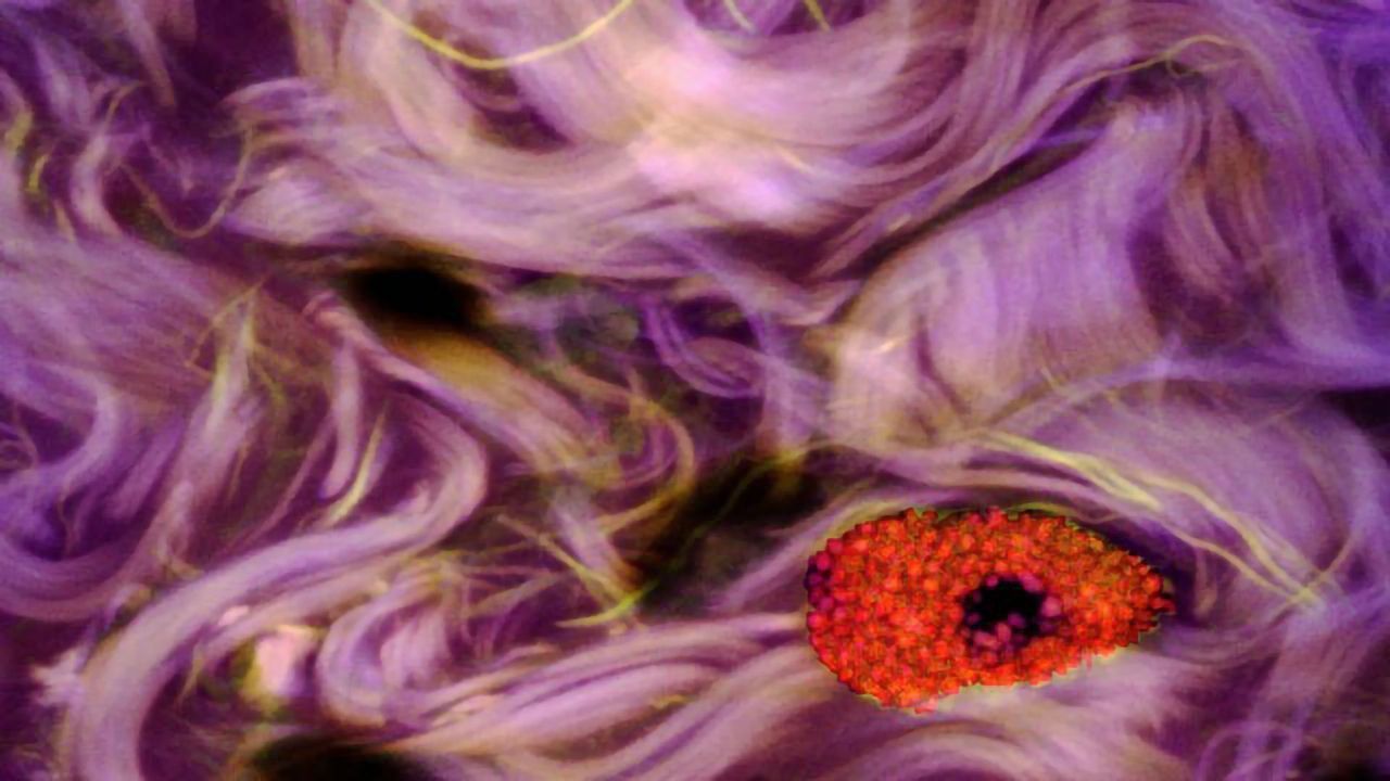 Mast Cell in Human Eye with Conjunctivitis