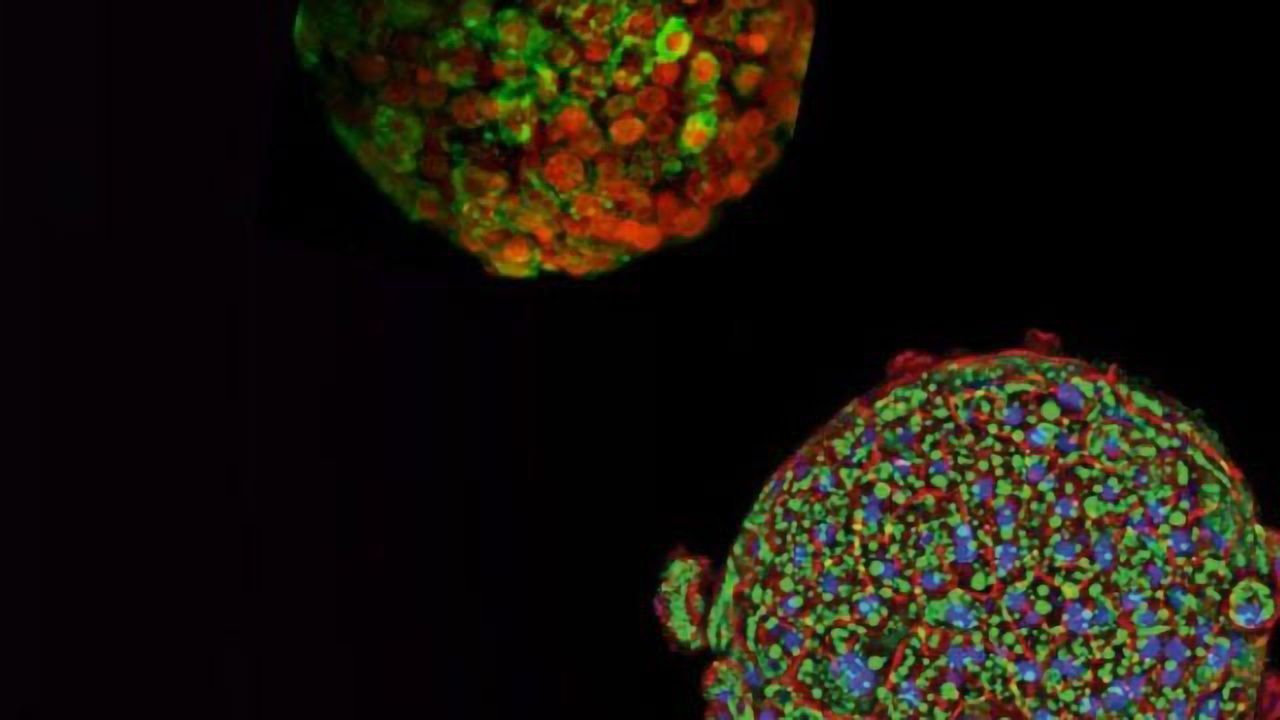 InSphero Launches Industry’s First Automation-compatible 3D Human Liver Disease Platform for NASH Drug Discovery and Screening