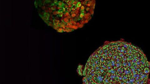 InSphero Launches Industry’s First Automation-compatible 3D Human Liver Disease Platform for NASH Drug Discovery and Screening