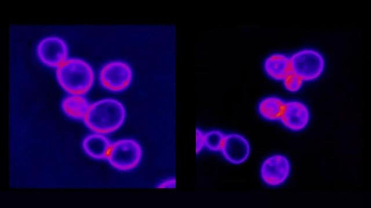 “Bloated” Cancer Cells May Have an Achilles' Heel