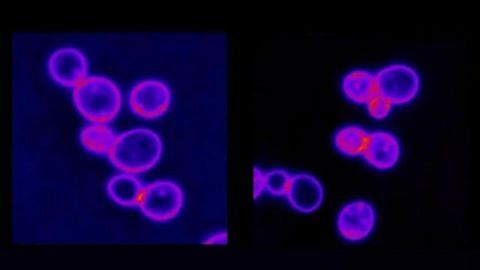 “Bloated” Cancer Cells May Have an Achilles' Heel