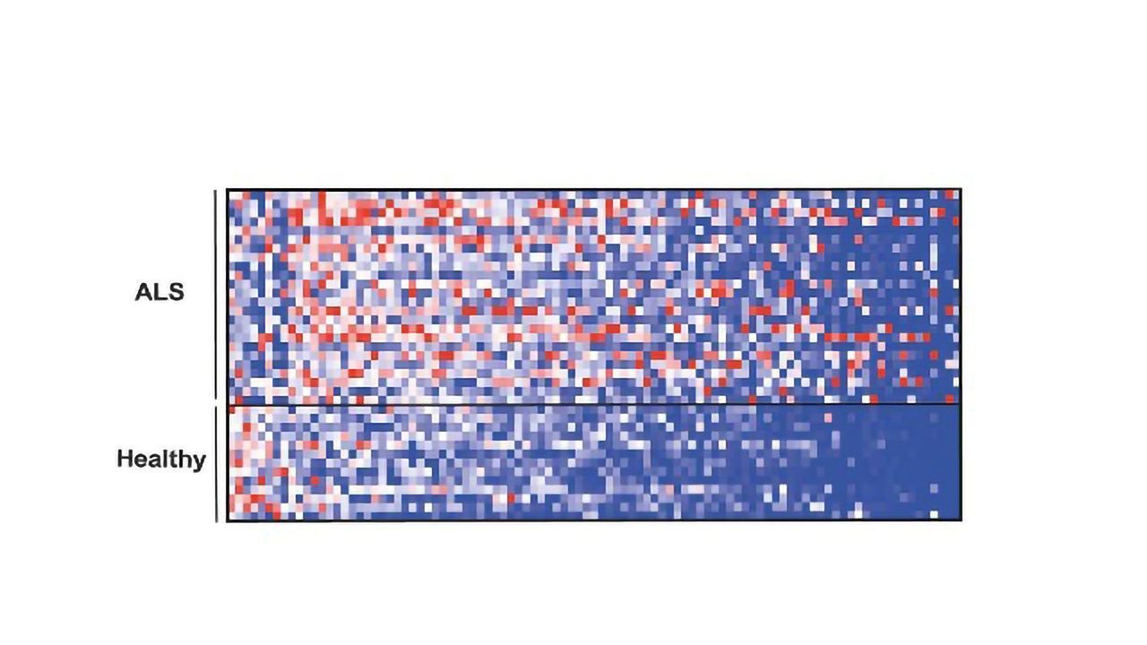 Intestinal Microbes May Have Role in ALS, Suggests Mouse Study