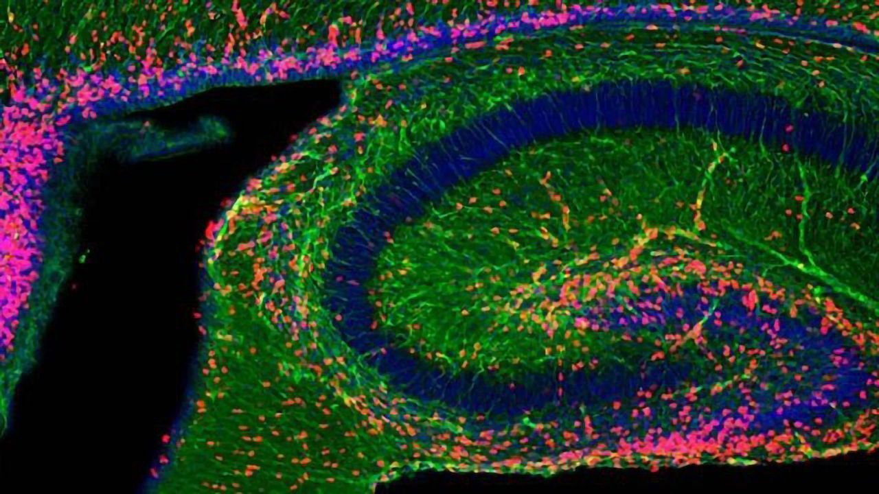 Cellular “Garbage” No More — Exosomes Show Potential in Treating and Diagnosing Brain Disorders