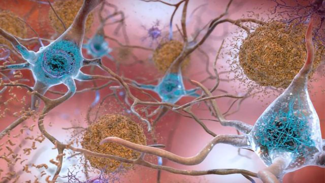 Mapping Protein-Gene Interactions in Alzheimer’s Disease