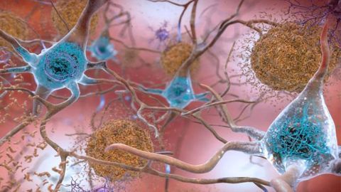 Mapping Protein-Gene Interactions in Alzheimer’s Disease