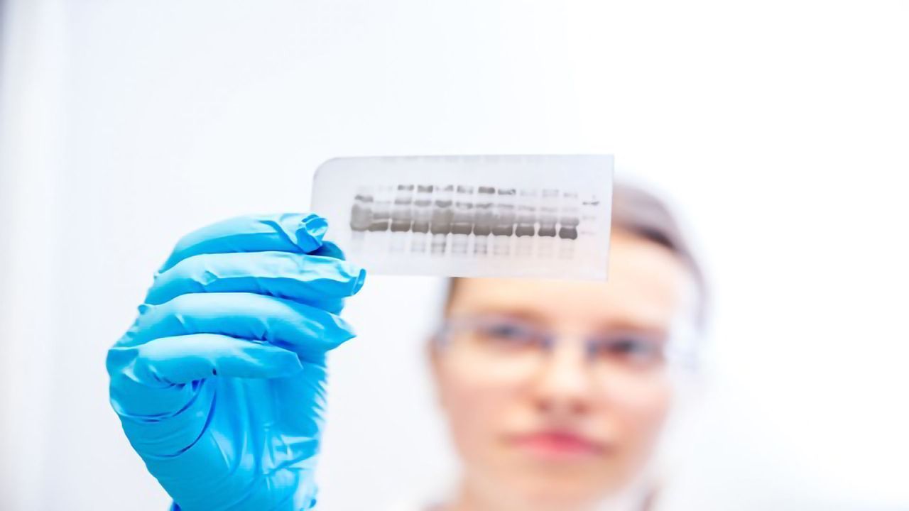 Why Does the Molecular Weight of My Protein Differ From the Theoretically Expected Weight?