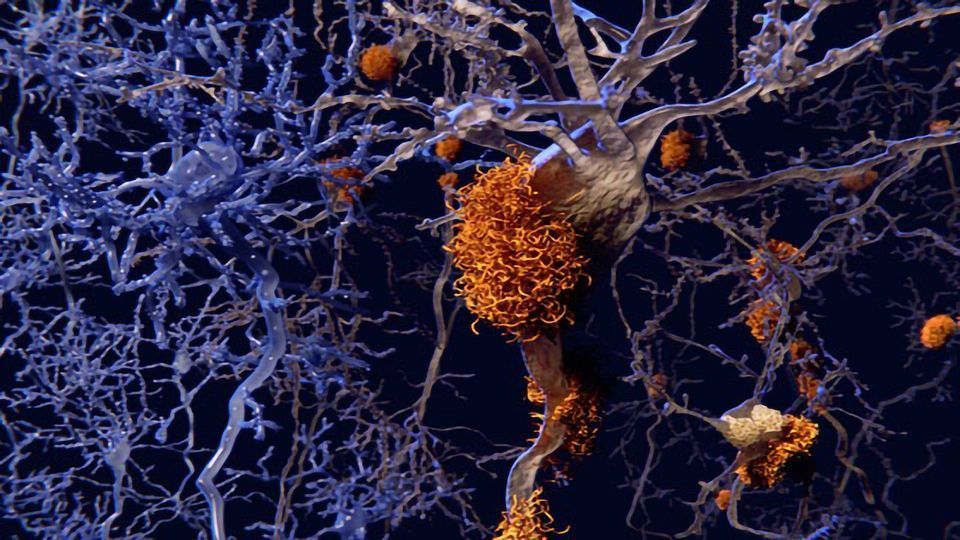 Electron Relationships in Alzheimer’s Protein Found to Be “Outside the Common Sense of Organic Chemistry” content piece image