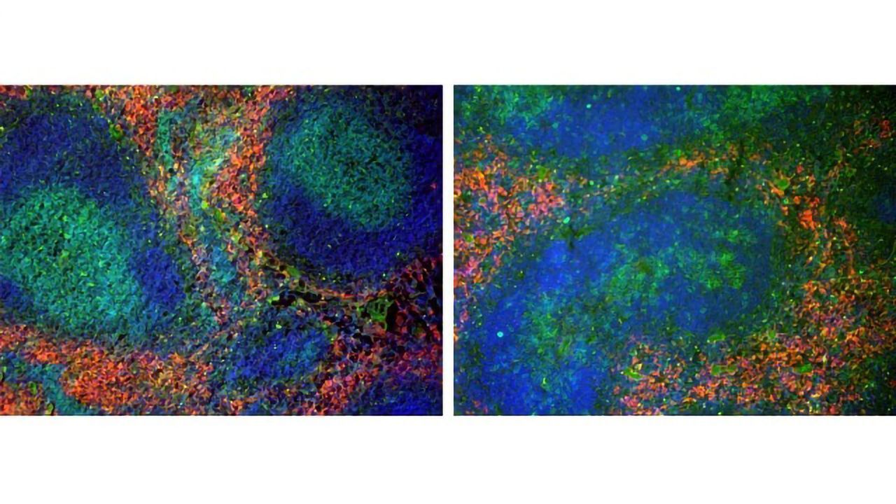 LRH-1's Positive and Negative Roles in Inflammation