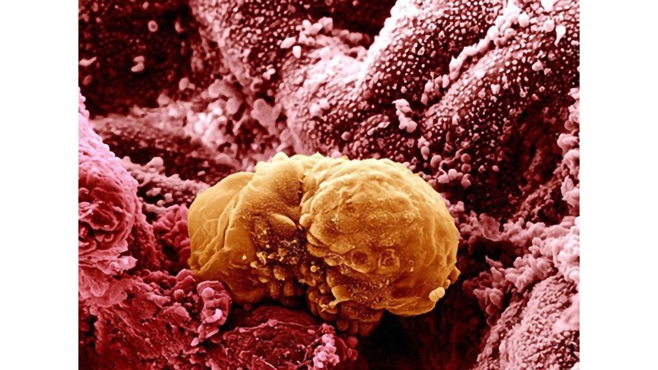 6 Day Old Embryo