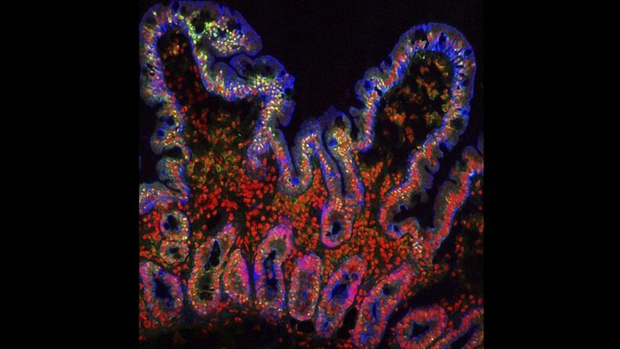 Villi From the Human Small Intestine