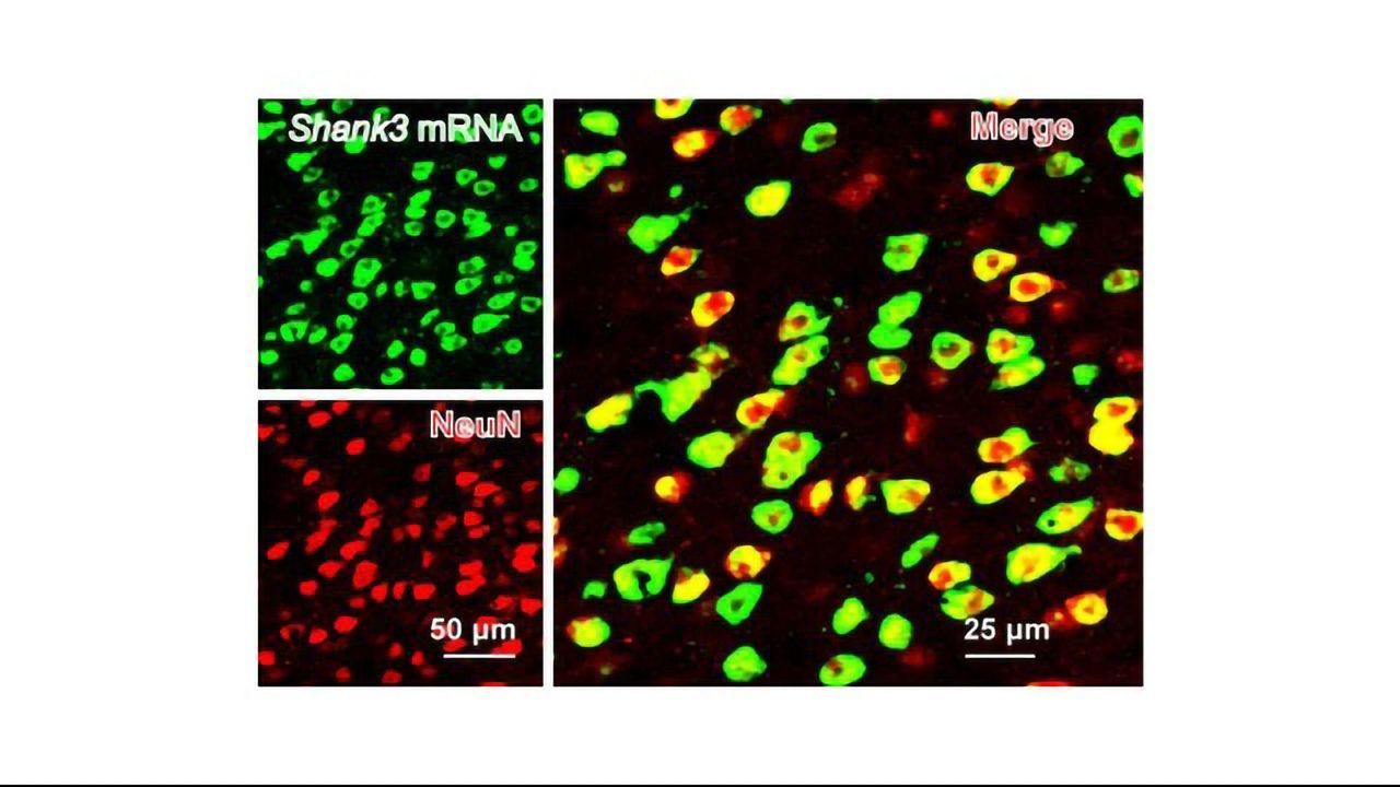 Decoding Social Struggles in a Mouse Model of Autism