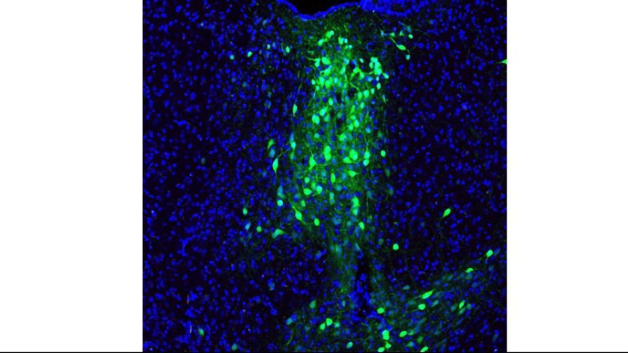 The Eye of the STORM: Microscopy Techniques in Contemporary Neuroscience