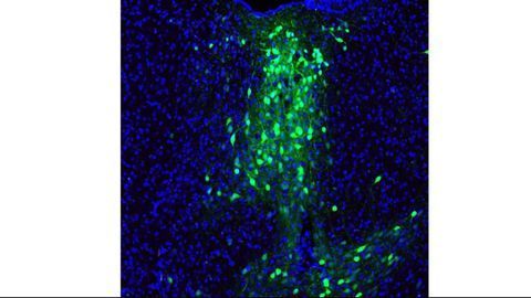 The Eye of the STORM: Microscopy Techniques in Contemporary Neuroscience
