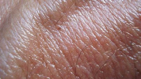 Analyzing the Skin by Studying Stem Cell Behavior