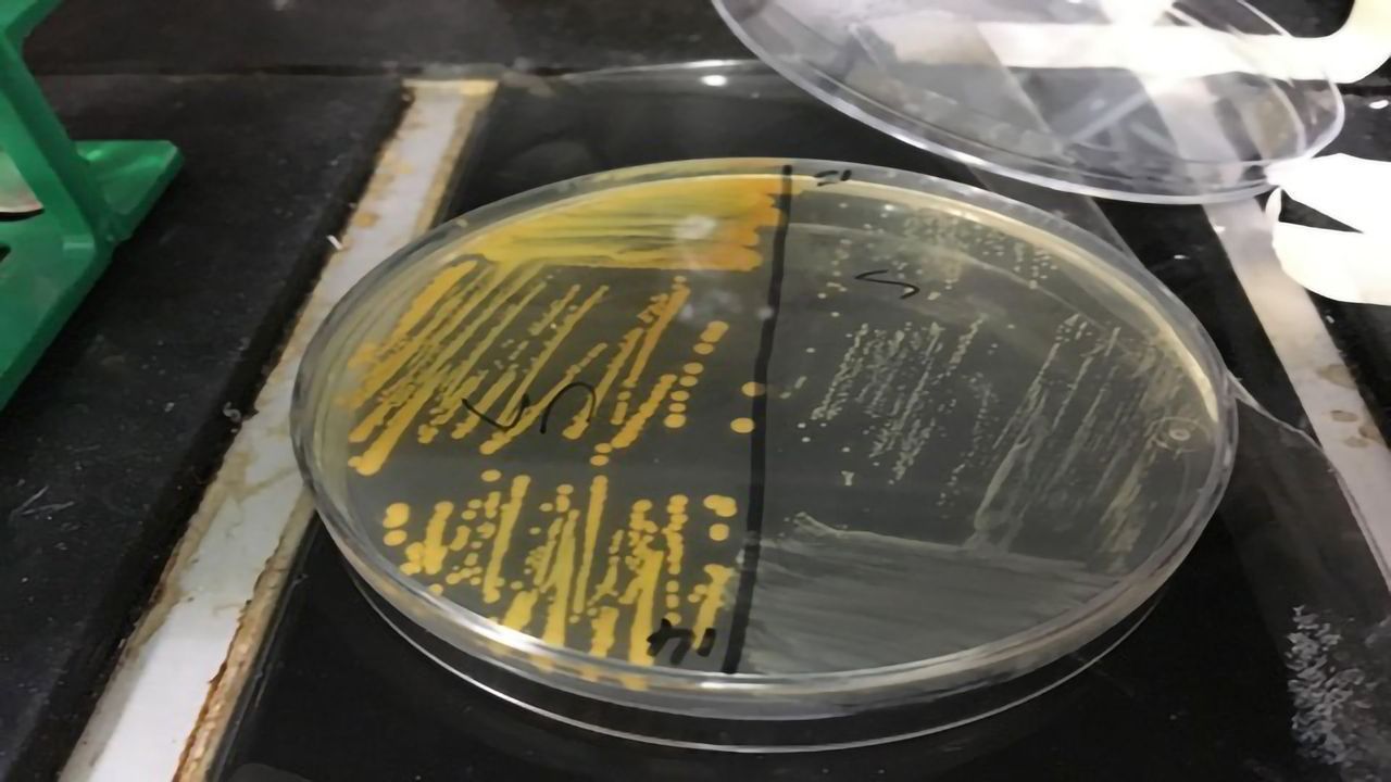Cigarette Smoke Makes MRSA Superbug More Antibiotic-resistant