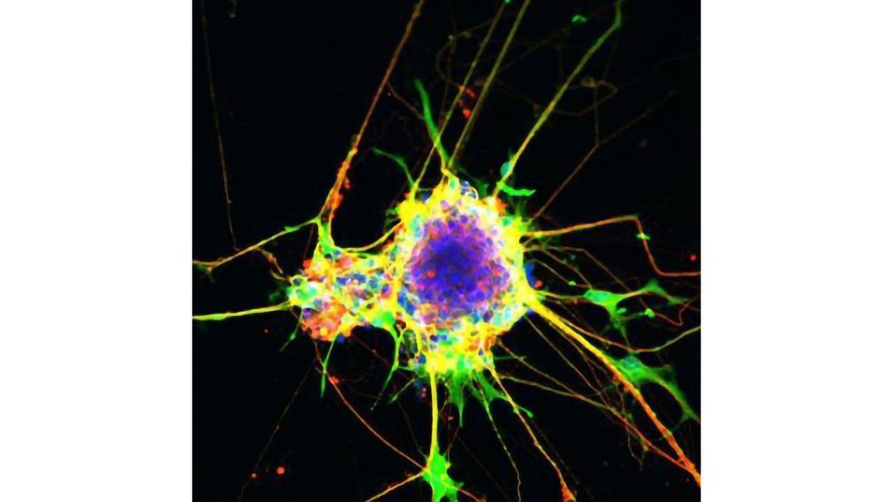 A Step Closer to Understanding Neurodevelopmental Disorders