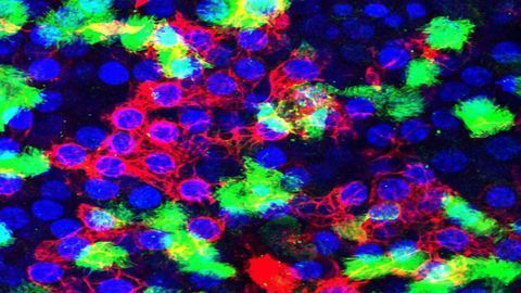 Lung Cells Hustle to Repair Damaged DNA Post-influenza Attack