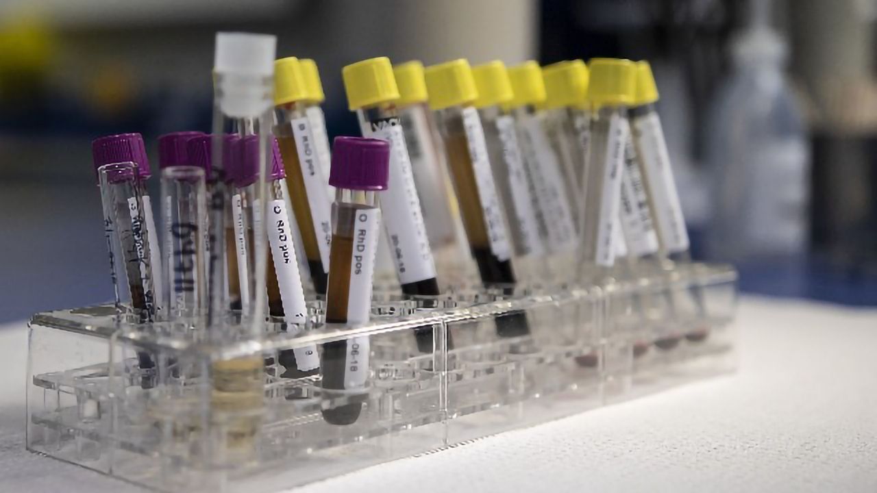 DIY Balloon Pump Could Facilitate Point-of-Care Testing