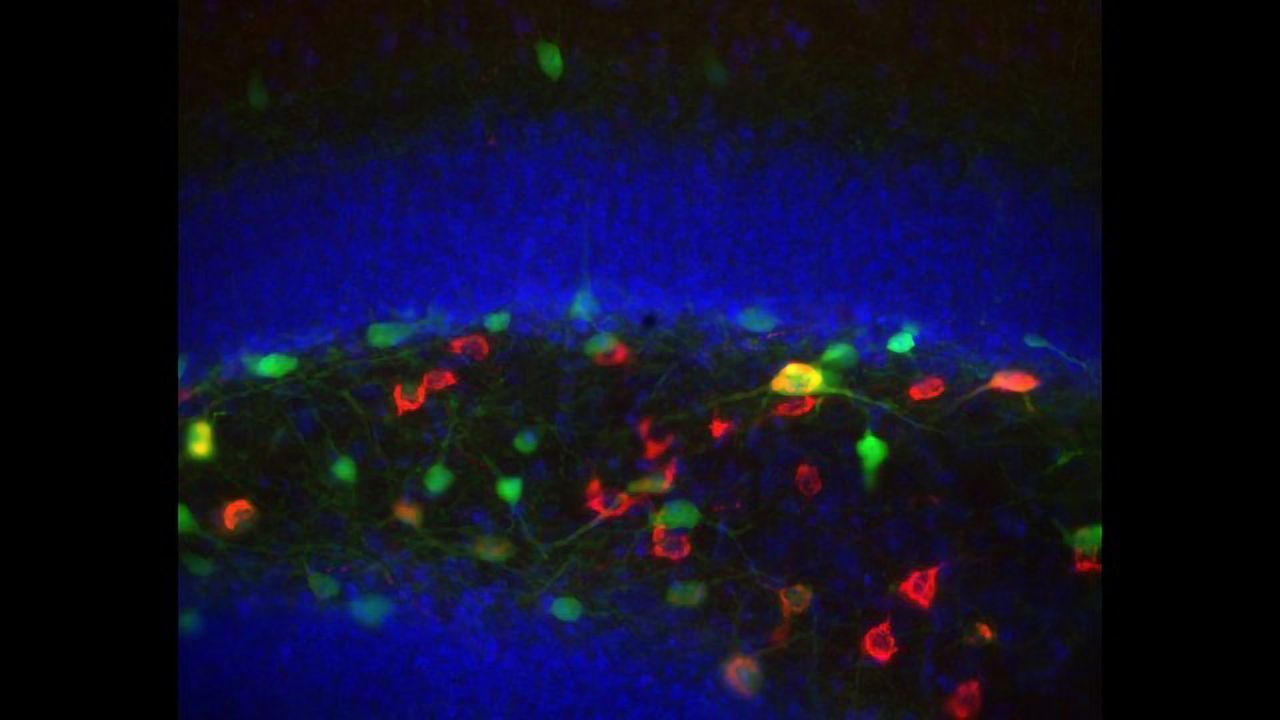 Neuronal Cell Body