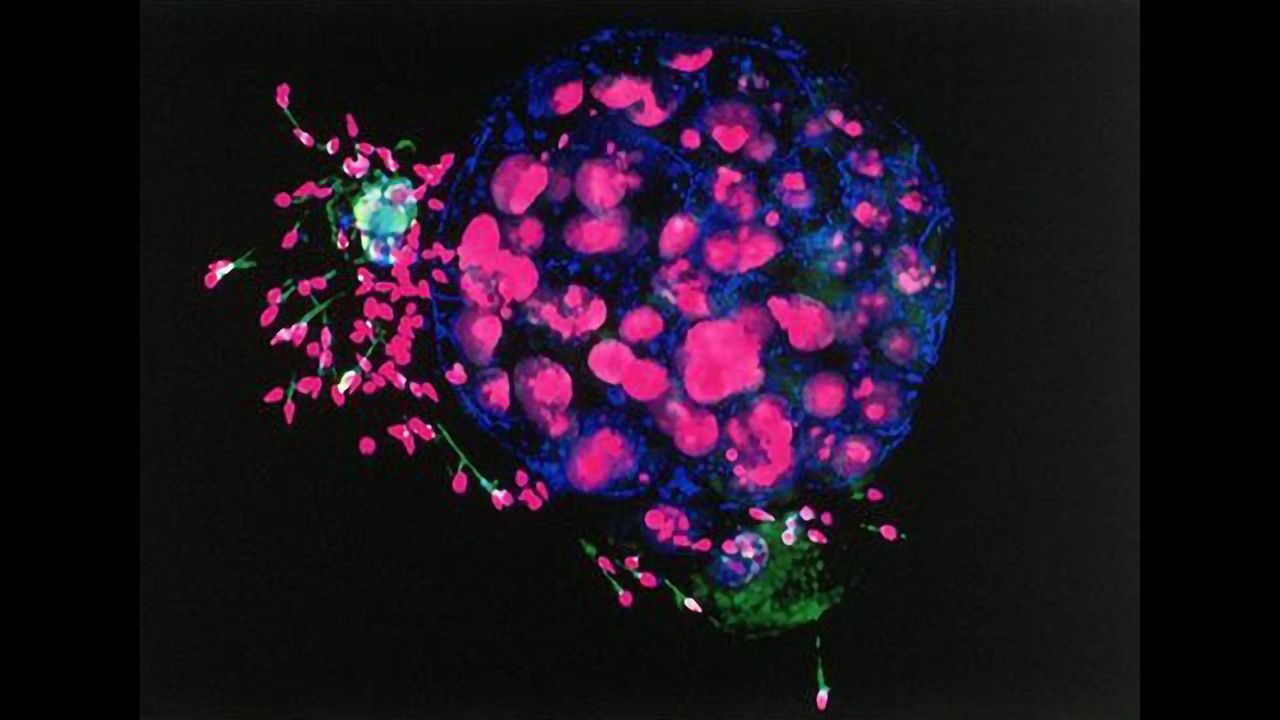 Human Embryo, With Some Remaining Sperm Cells